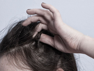 Что такое трихотилломания и ее симптомы