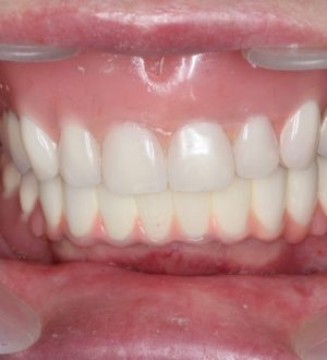 Современные методы лечения зубов и десен: обзор и рекомендации