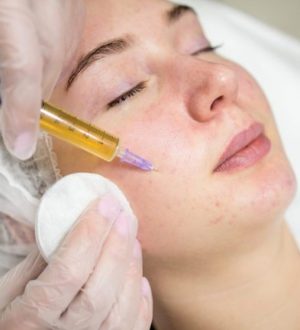 Плазмолифтинг: инновационный подход к молодости и красоте