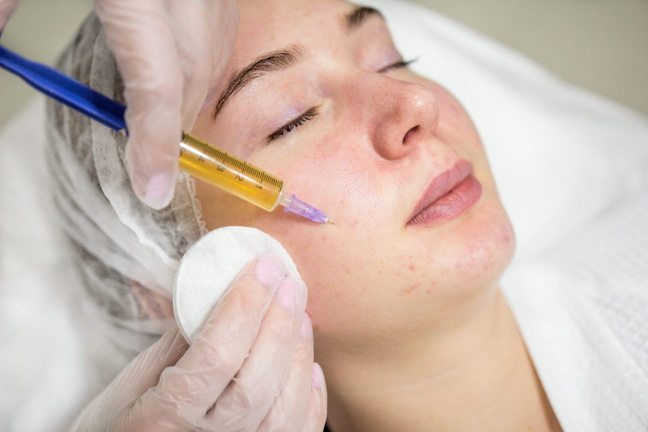 Плазмолифтинг: инновационный подход к молодости и красоте