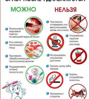 Подготовка к процедуре