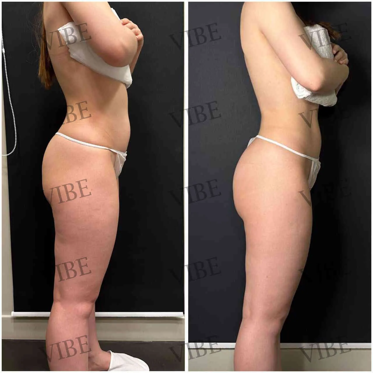 Эндосфера терапия: инновационный аппаратный массаж для красоты тела и лица